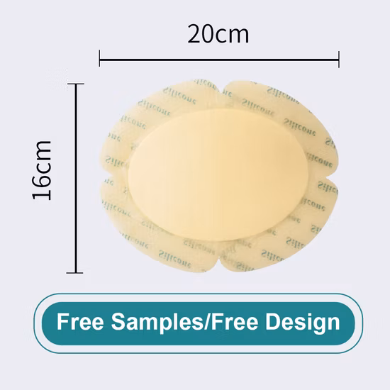 FDA CE Medical Alginate Dressing for Wound Care/ Venous and Arterial Leg Ulcer/ Diabetic Ulcer/ Donor Sites